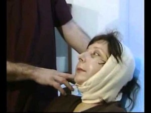 Блефаропластика и СМАС лифтинг. Хирург Гогиберидзе О.Т. 