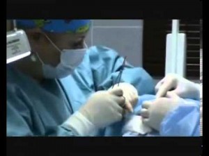 Отопластика. Хирург Вакорина Е.И. 